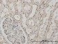MSI1 Antibody (monoclonal) (M05)